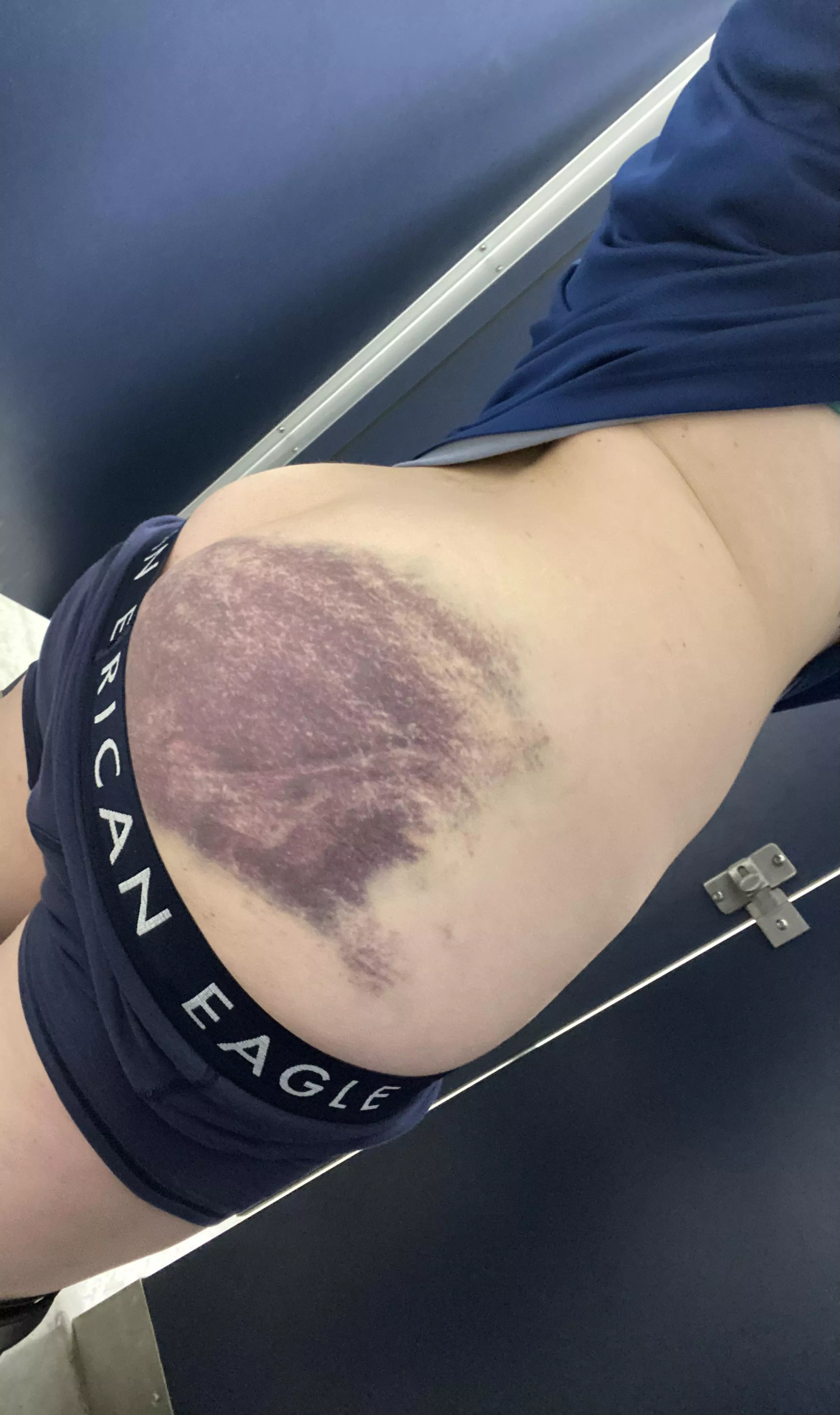 [NB] butch top, first dungeon experience as a bottom. Asked mommy to do her worst. So sore, so proud ⛓️👋🏻