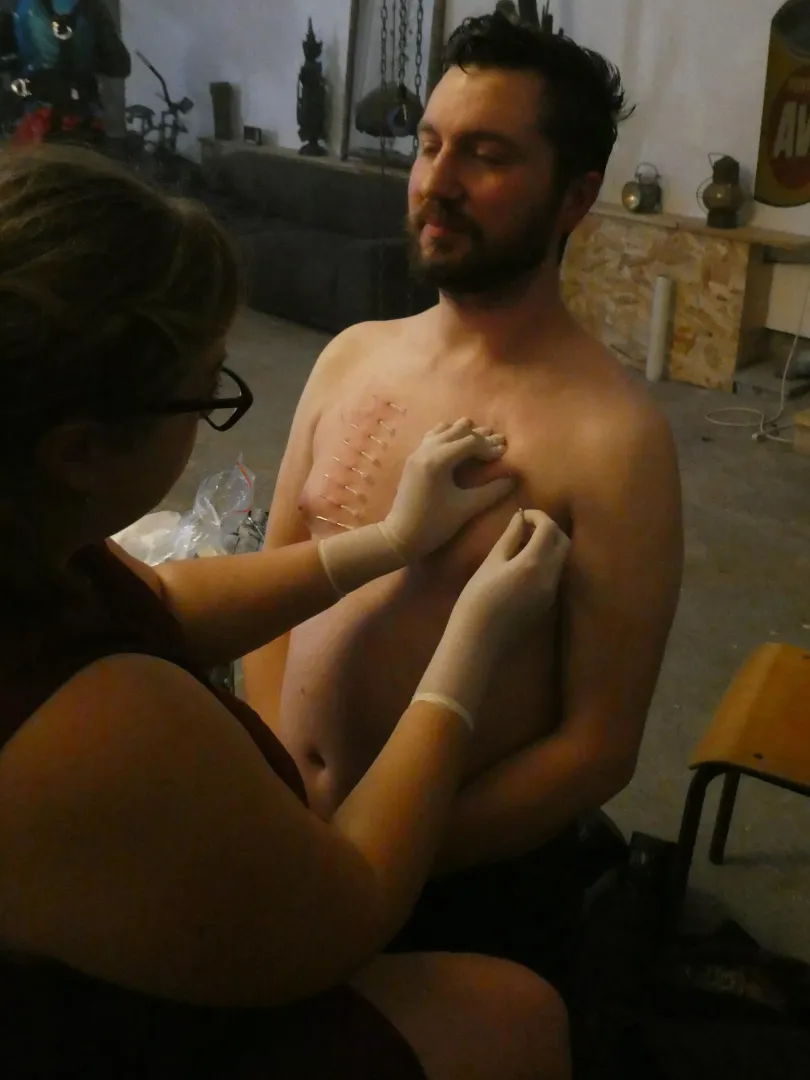 Needle play
