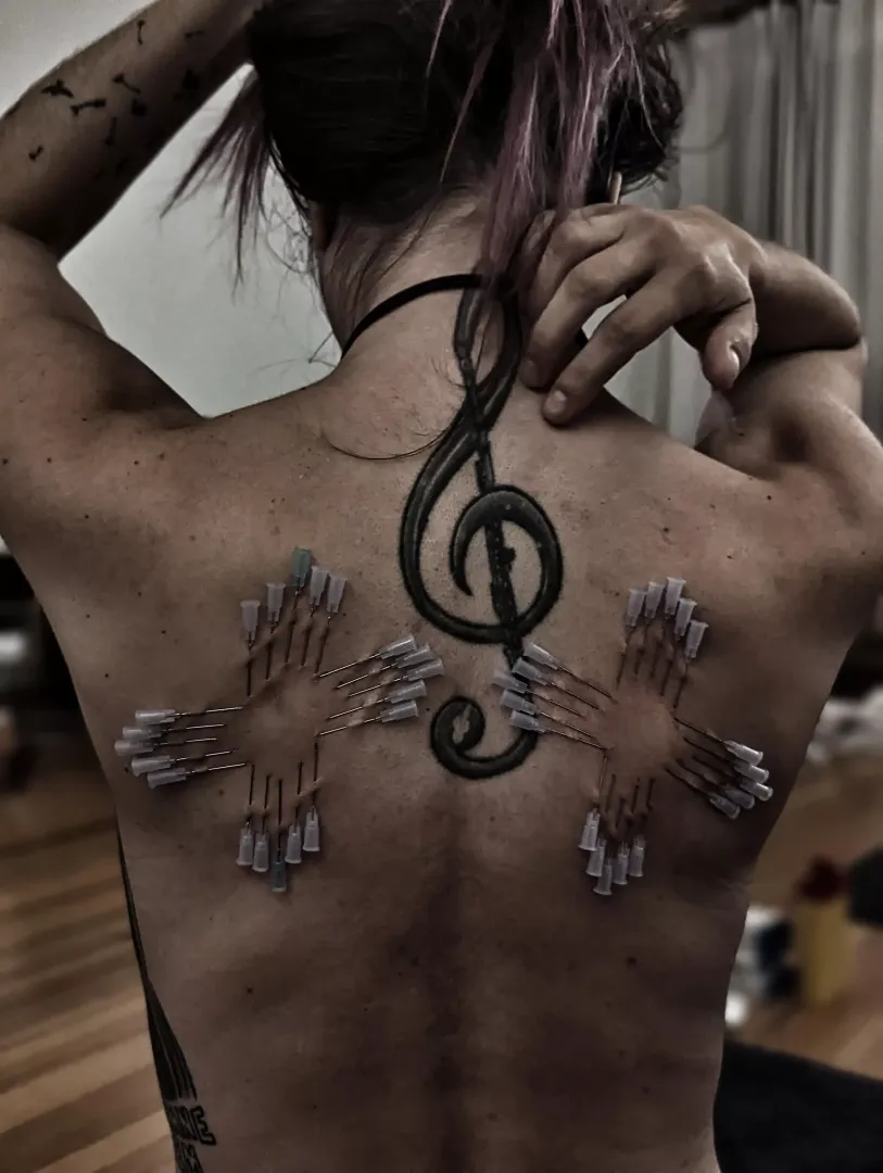needles in movement