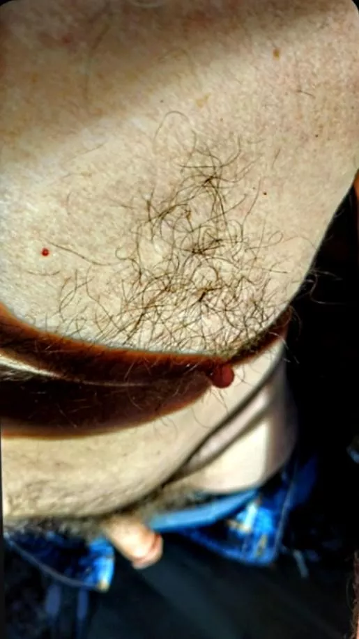 Nip and (un)Tuck 67