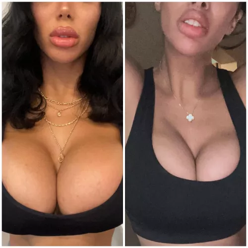 (OC) Finally got my lip lift and cat eyes surgery! One more surgery and my transformation is complete.