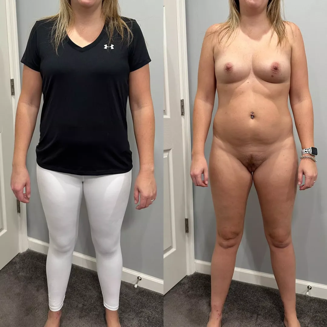 On or off?
