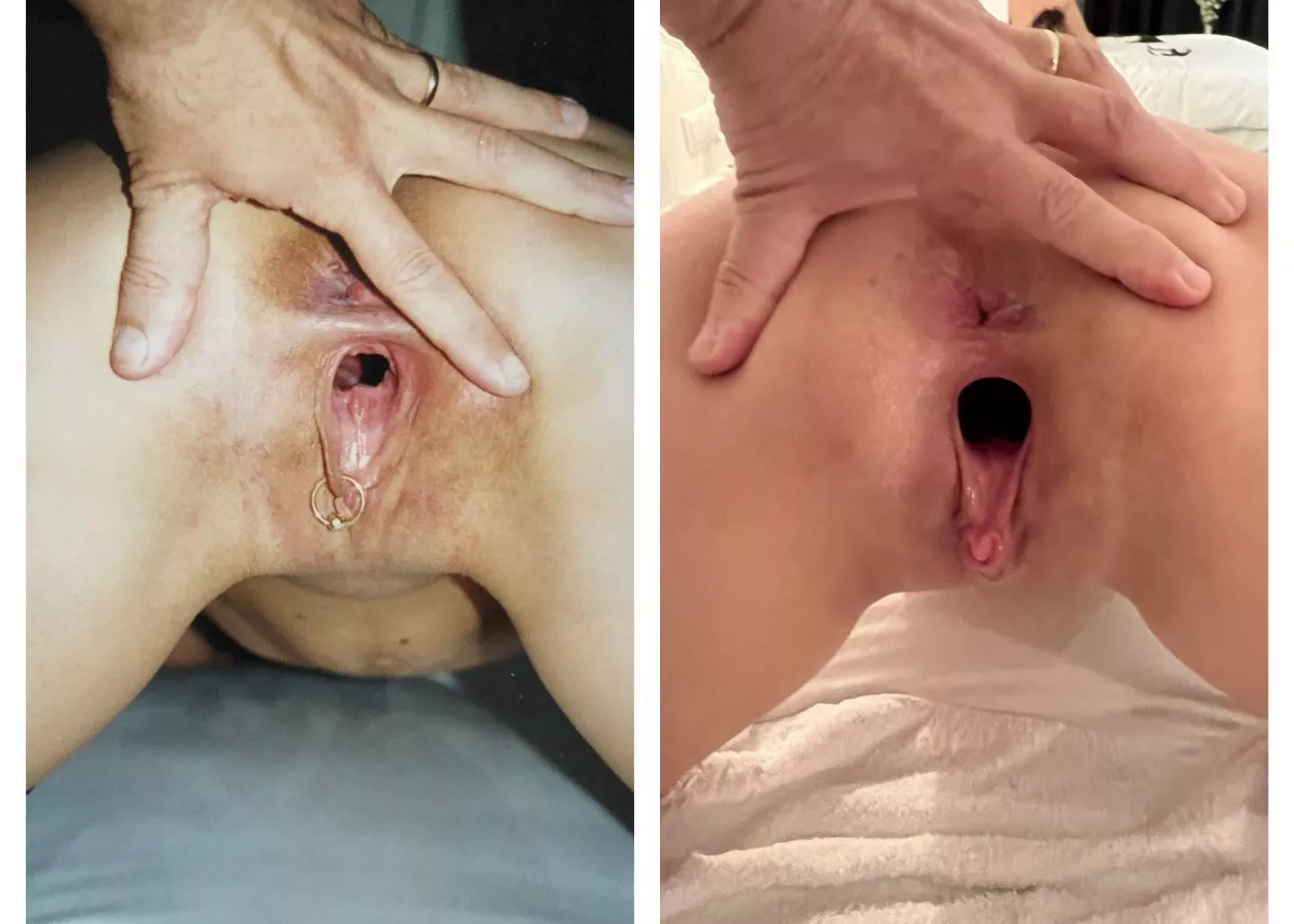 One more progression pic, on my knees