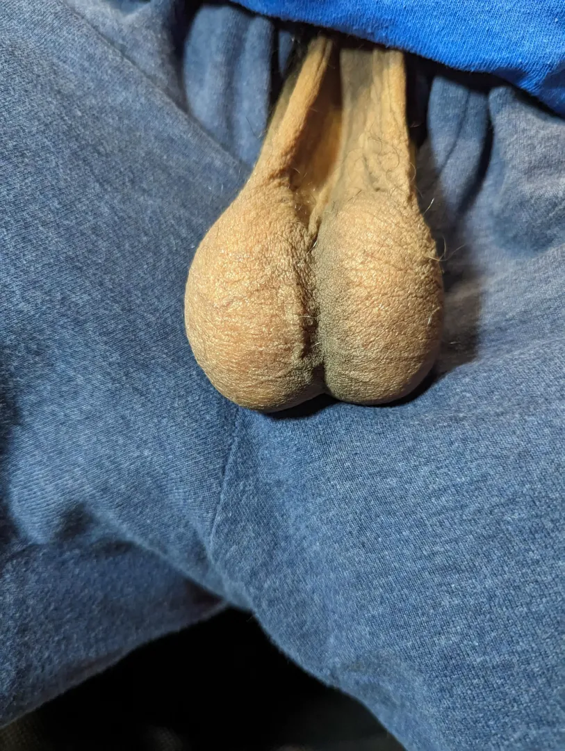 Only Balls