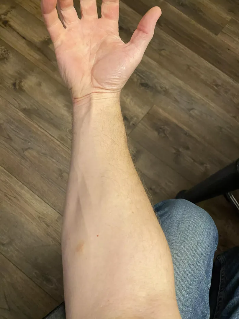 Only my forearm