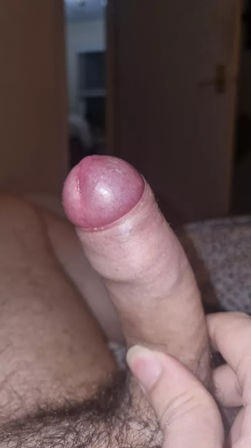 Options on my phimosis cock? 