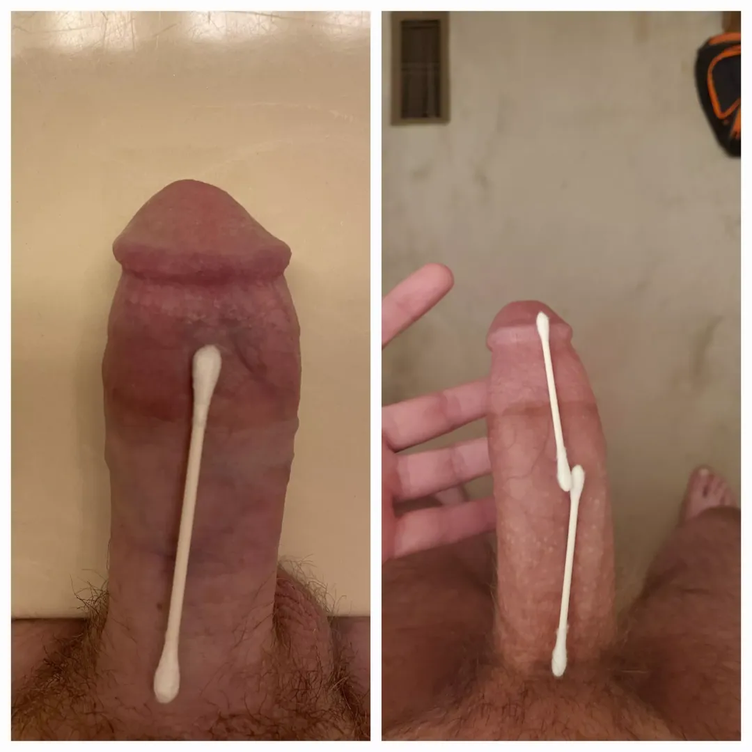Outsized u/whatiwant111 on the left. It wasn't even close!