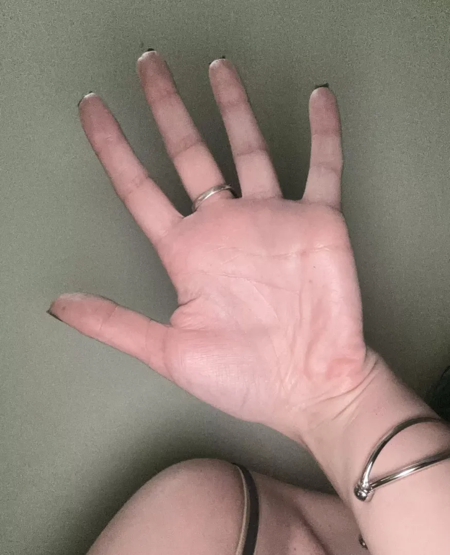 Palms with a ring