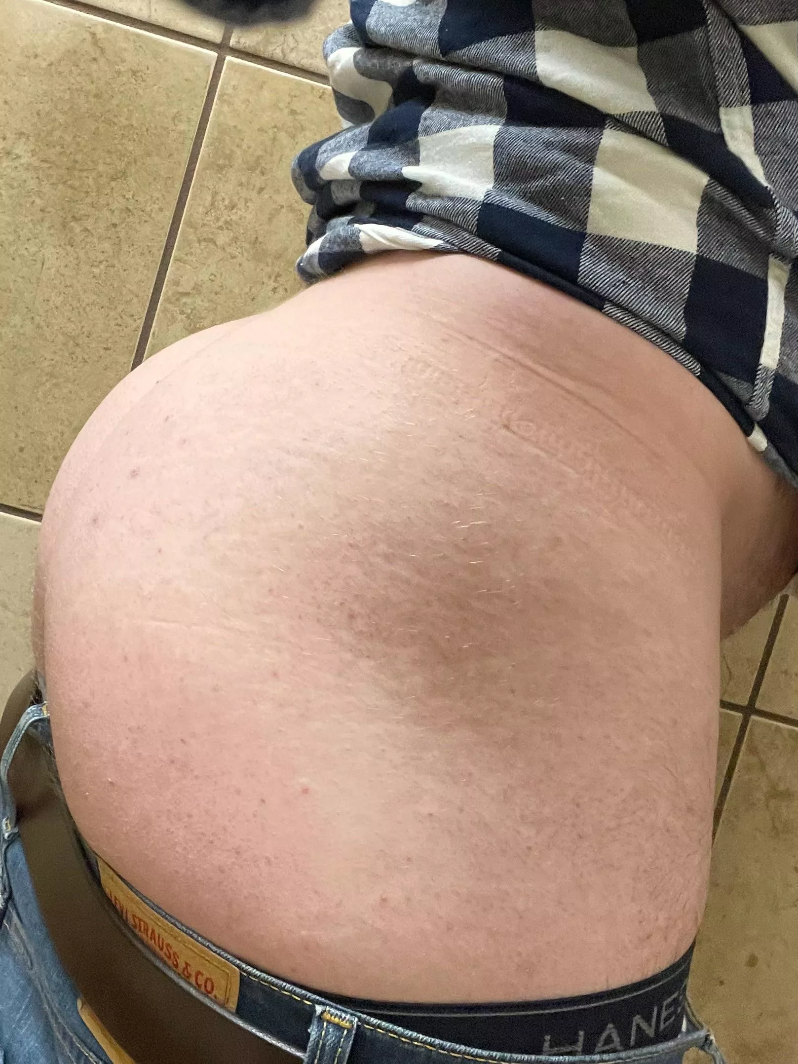 Peggable?