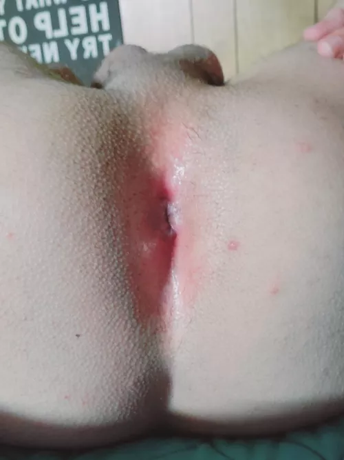 Pink bussy anyone?
