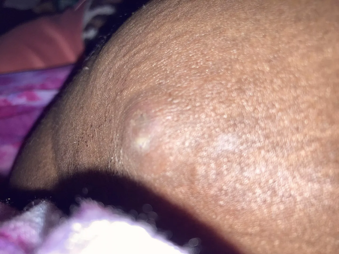 please help, how do i get rid of this asap? read my comment for details