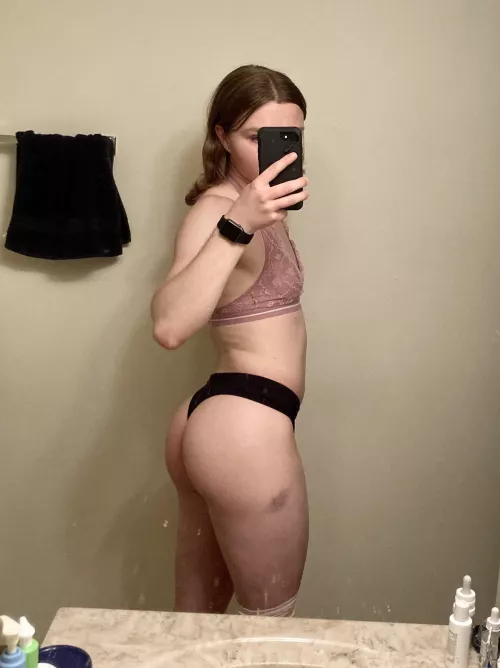 Please ignore the bruise on my thigh