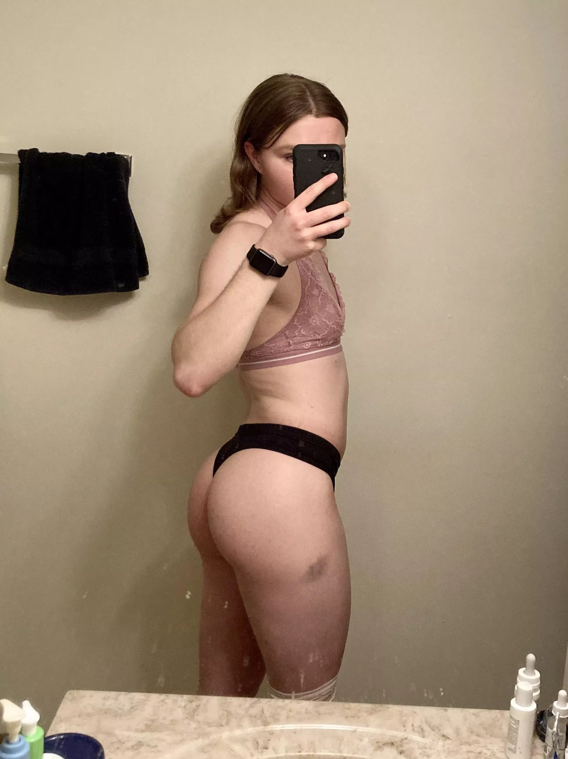 Please ignore the bruise on my thigh