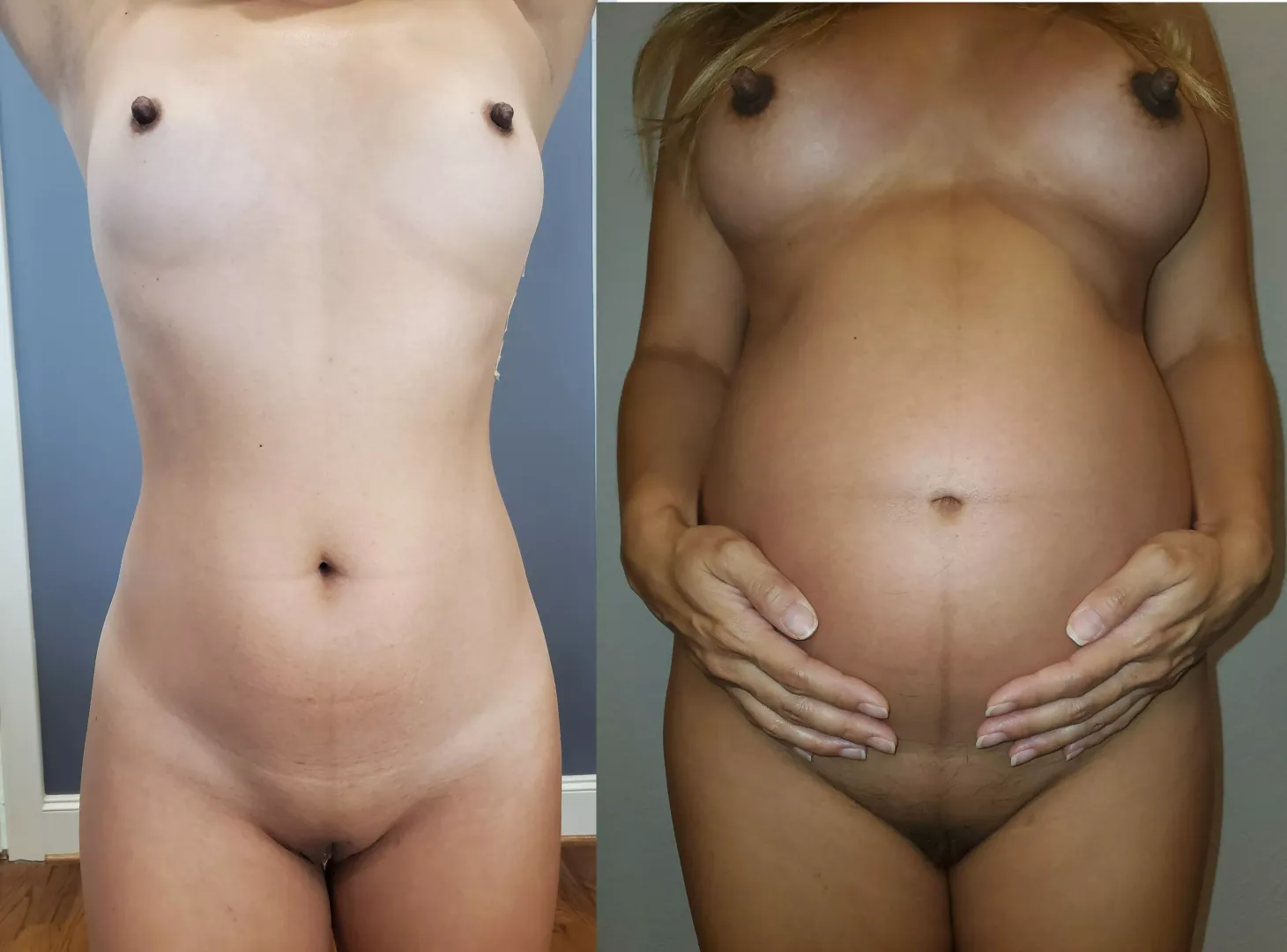 Pregnancy has really done a number on my body and belly button
