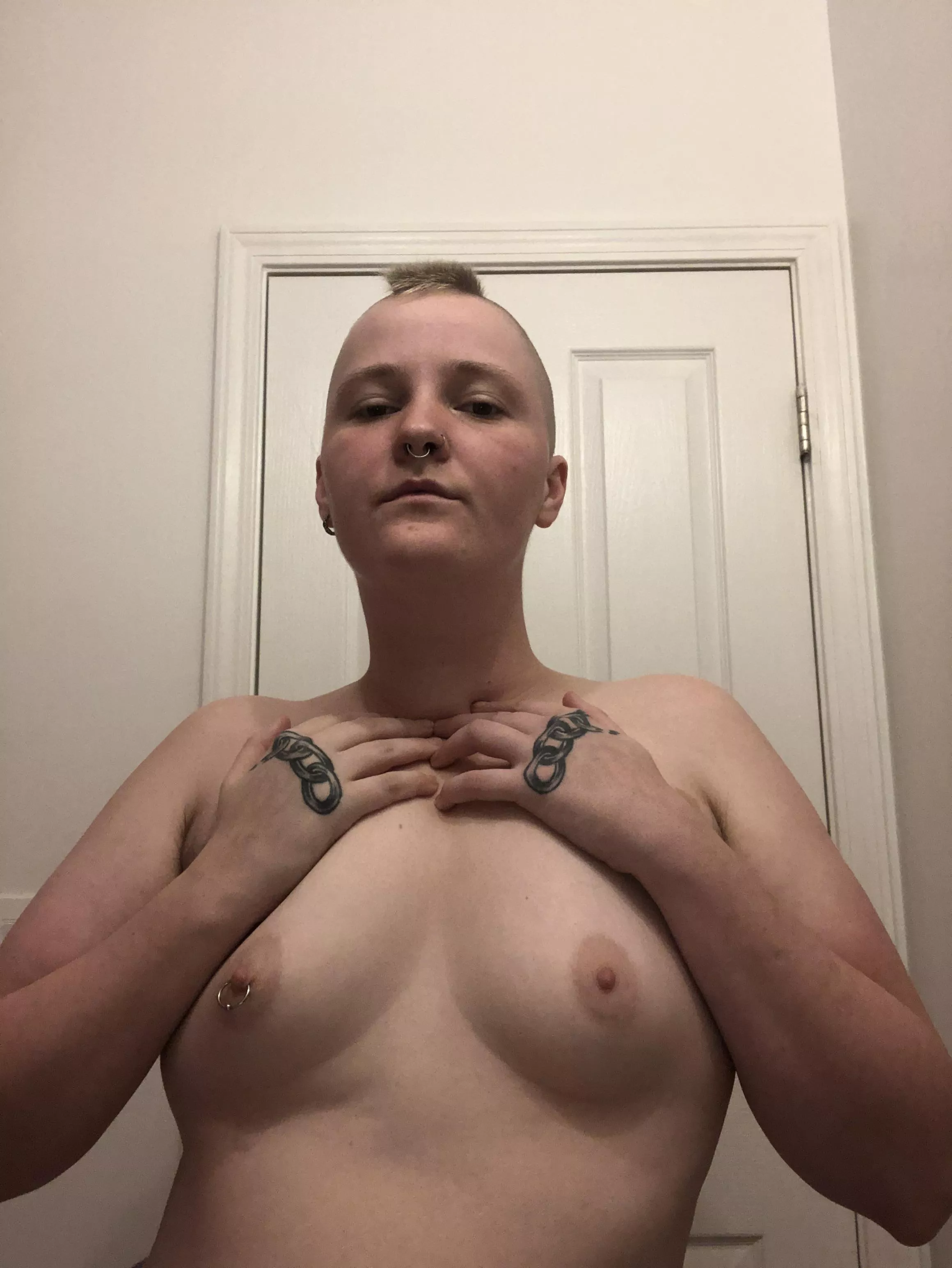 Pre-op Tiddy boi