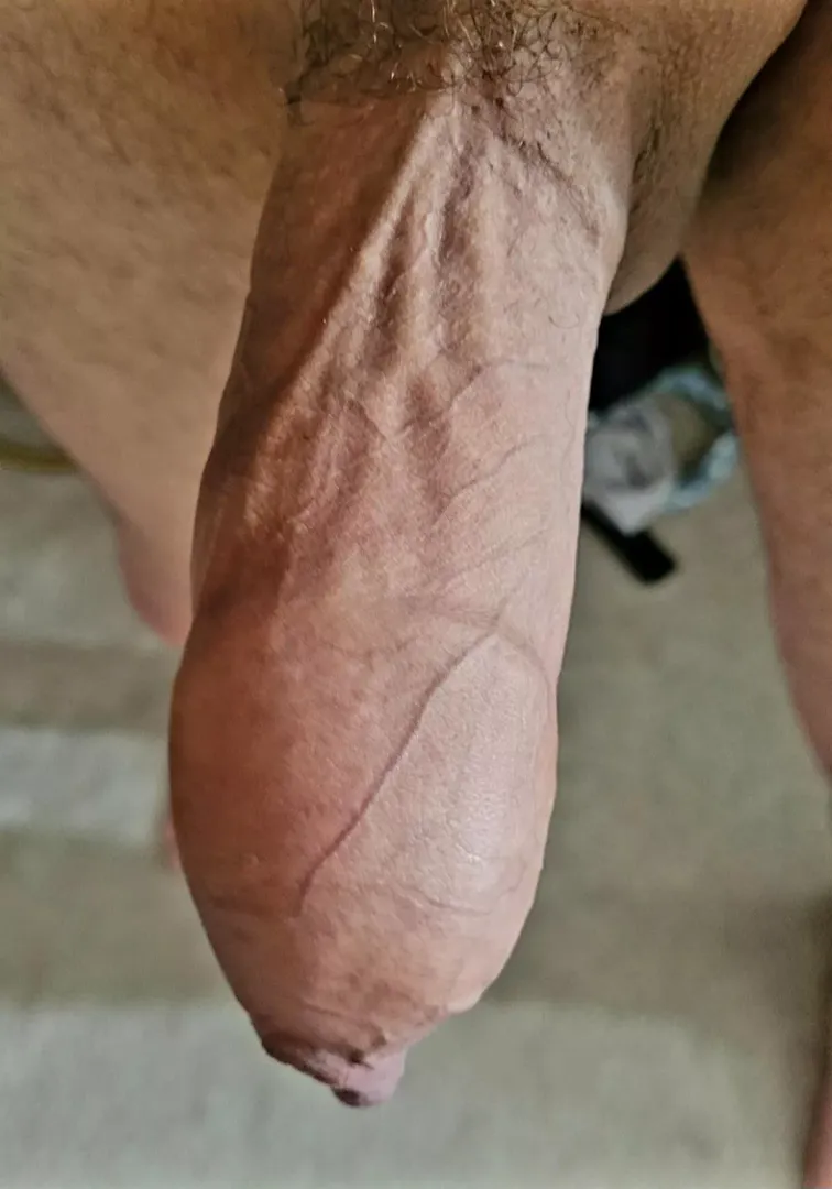 Pull it back and explore? 
