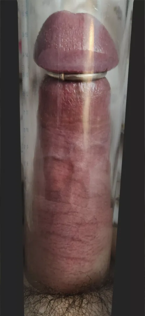 Pumping with a ring
