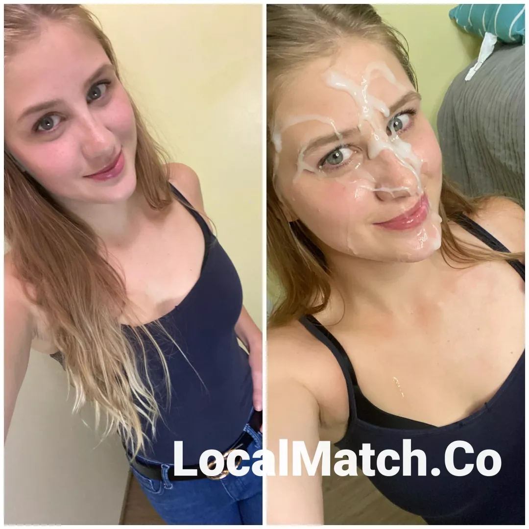 Sharing my before and after selfies! Recommended here 😇
