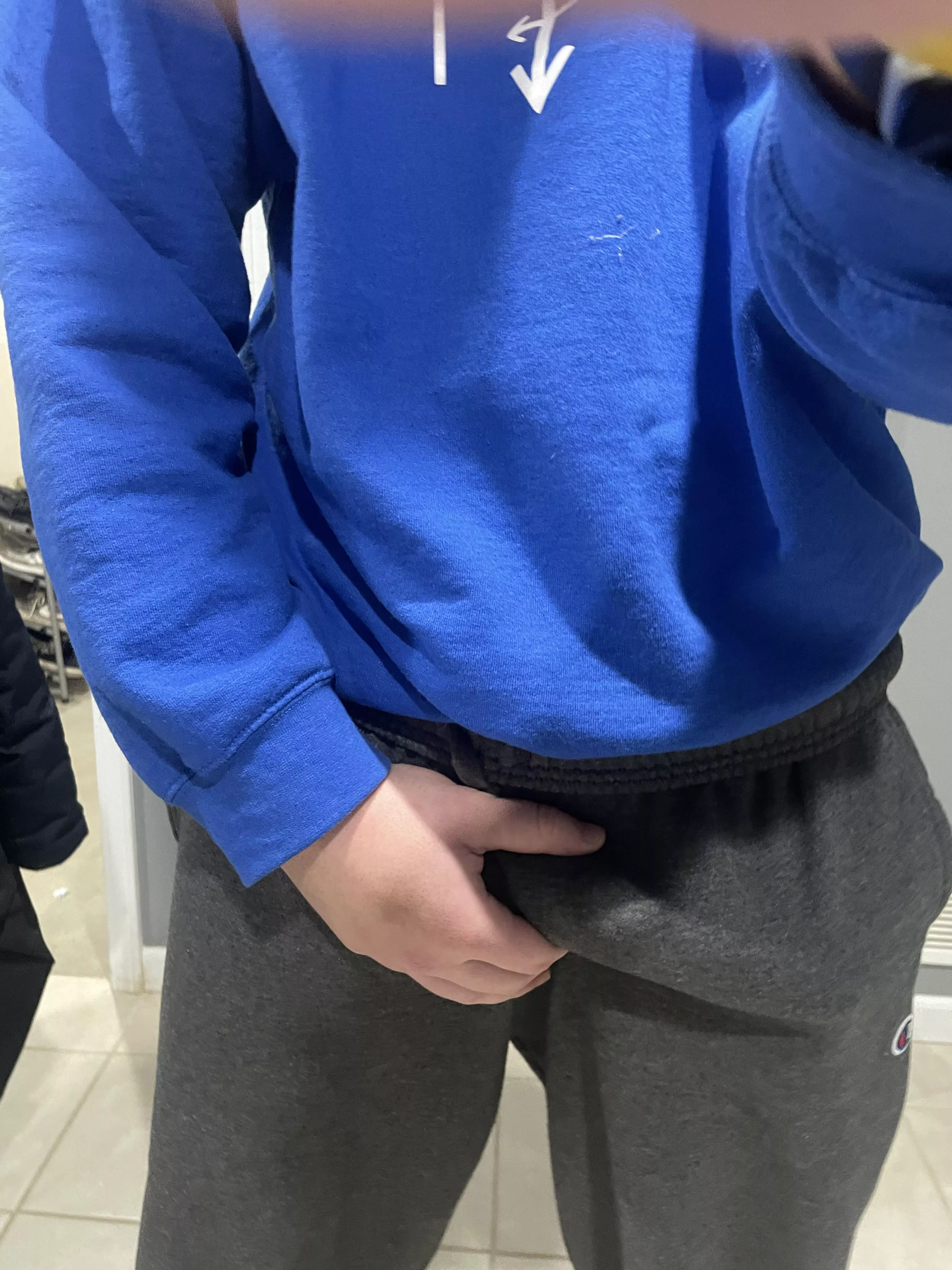 Should I go out in public like this?