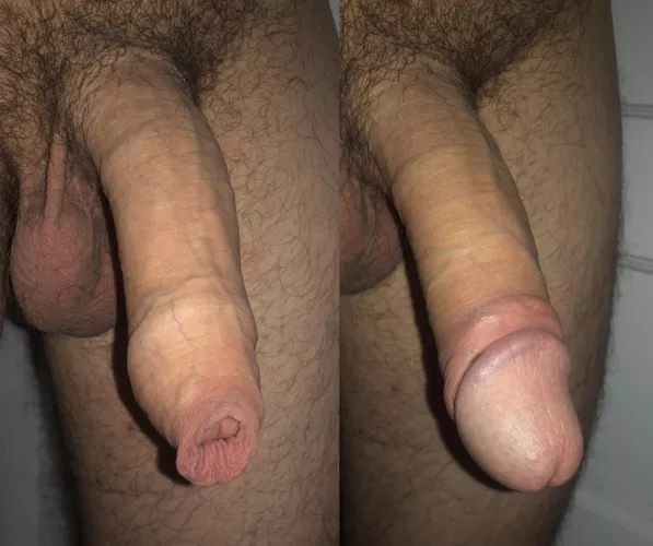 Skin covering the head compared to bare head