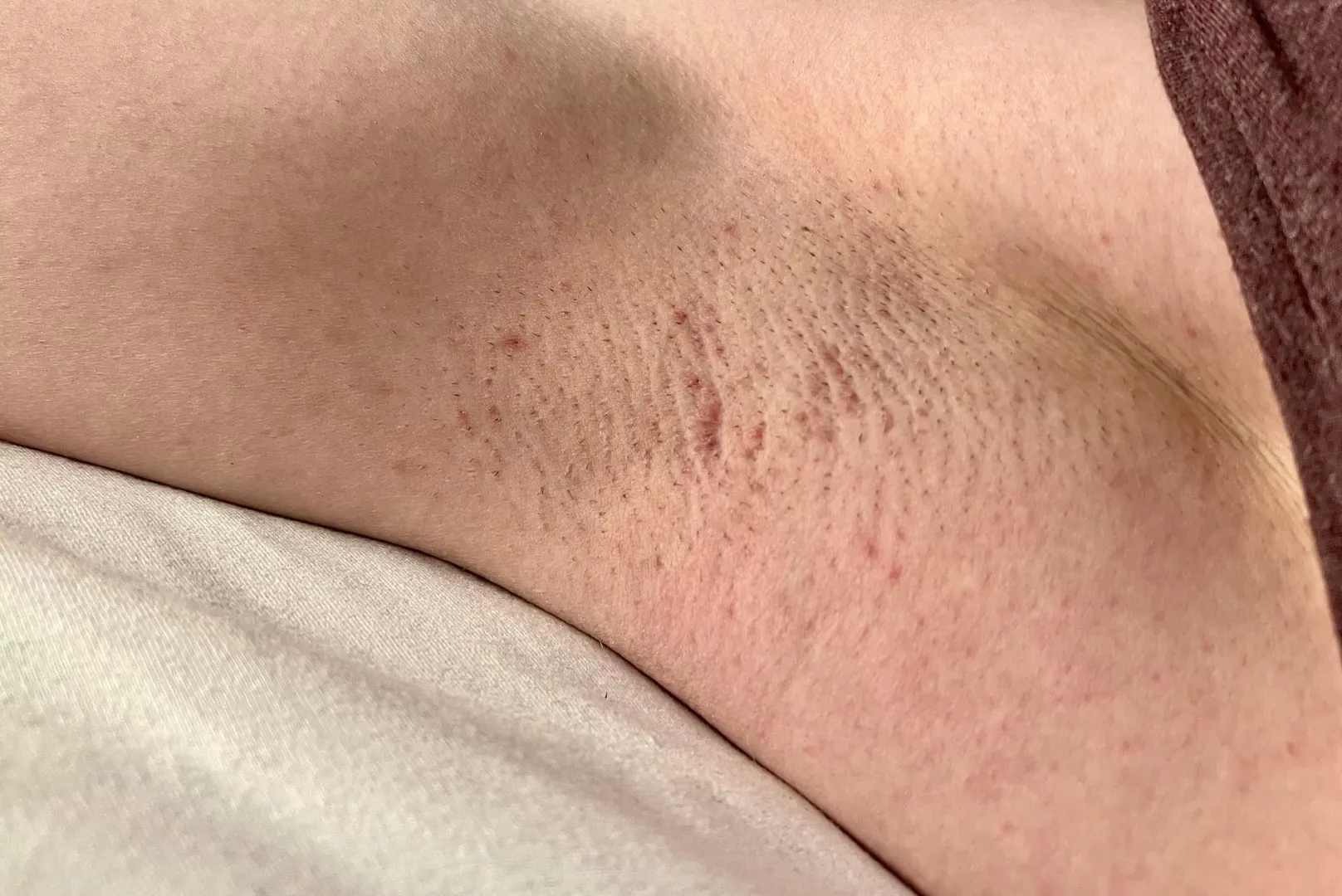 Smelly morning pit
