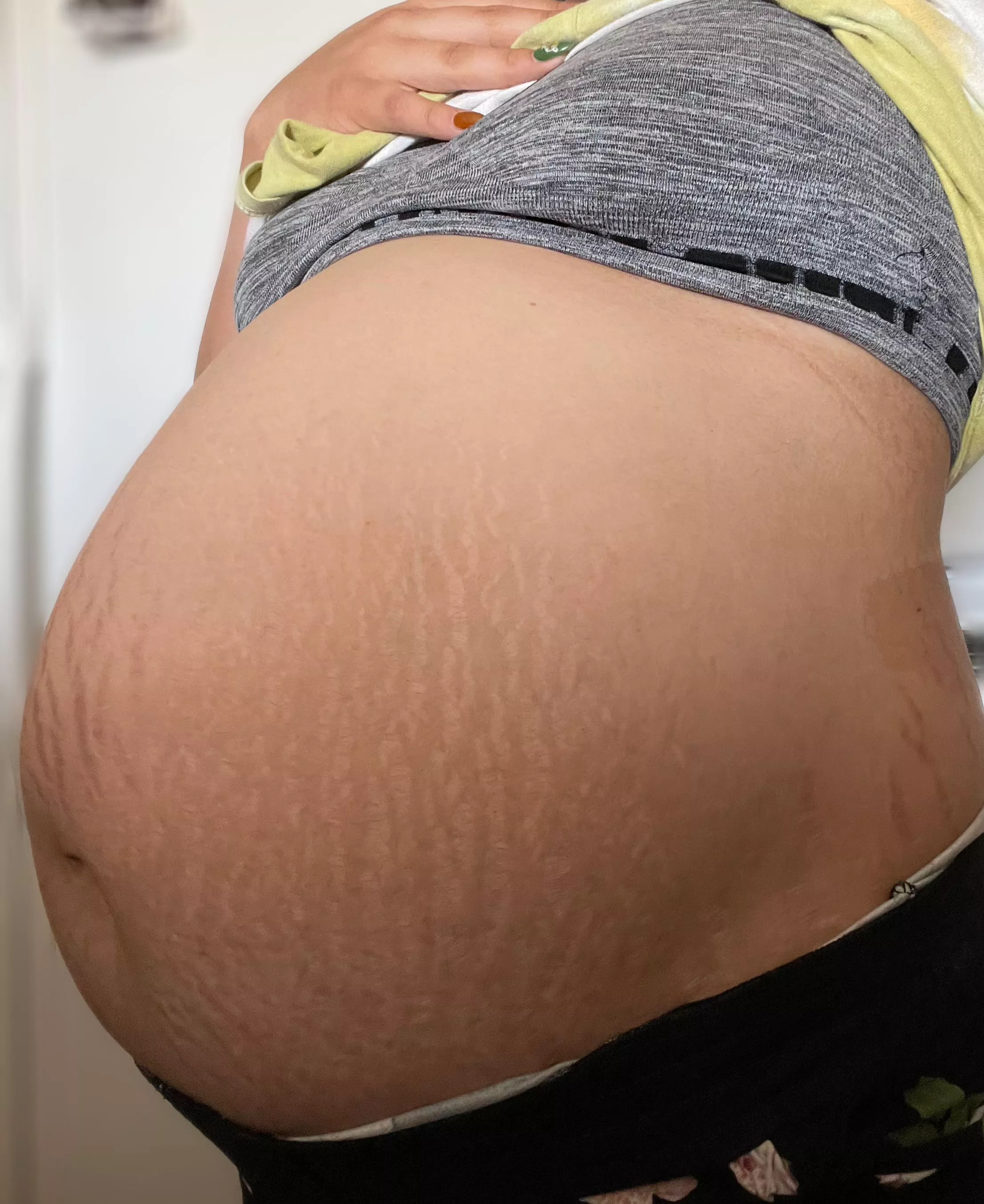 So stretched out 🙈🤰🏻