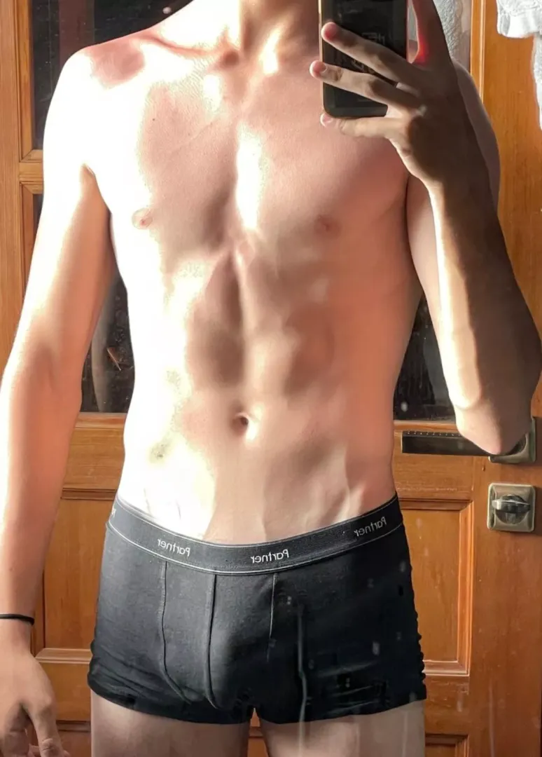 Soft bulge