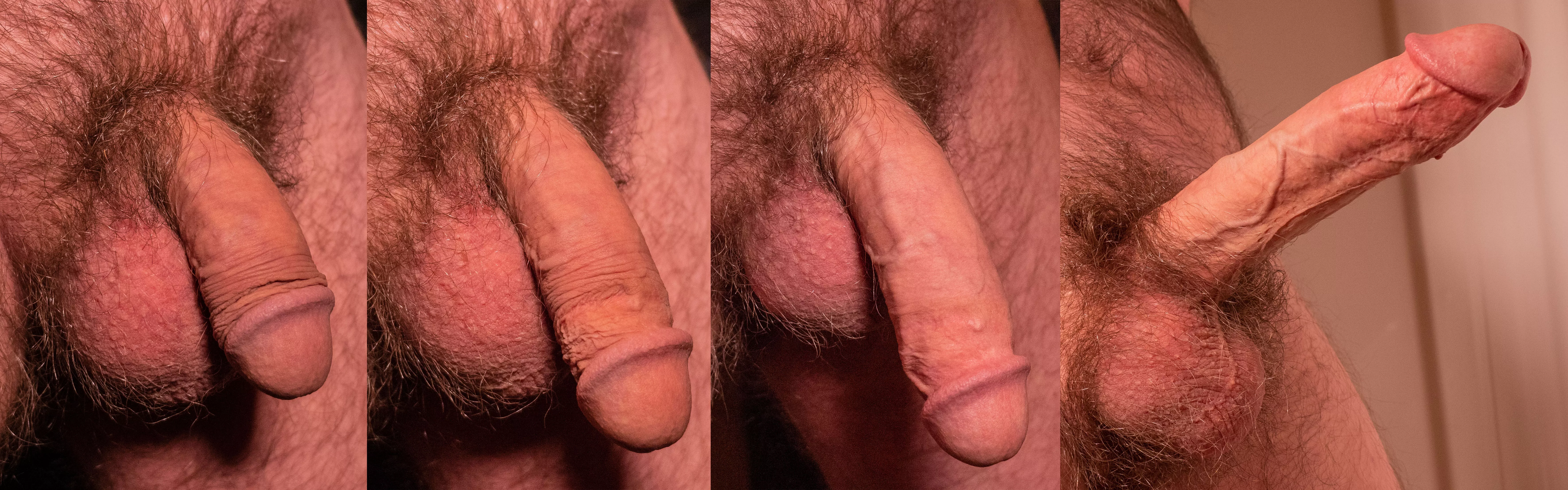 Soft to Hard Progression