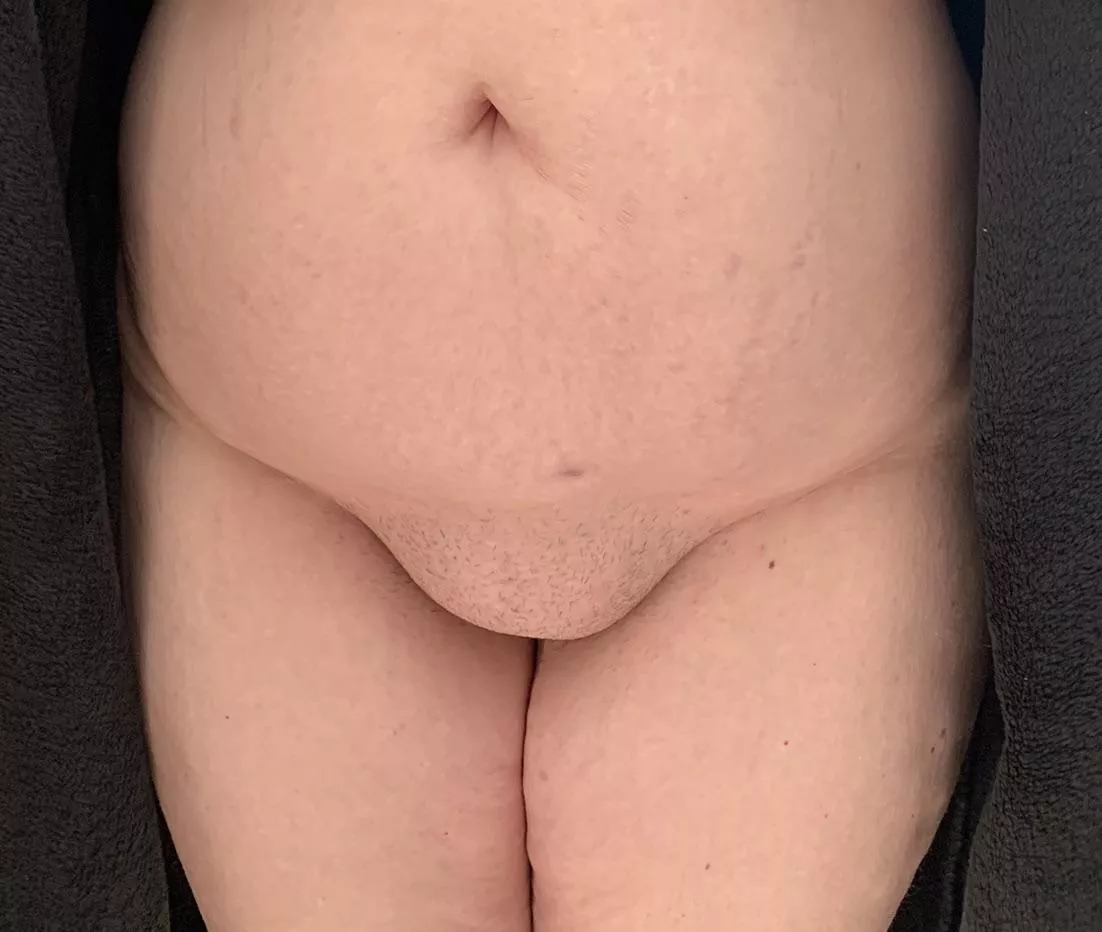 Some bald pussy for you to all enjoy.