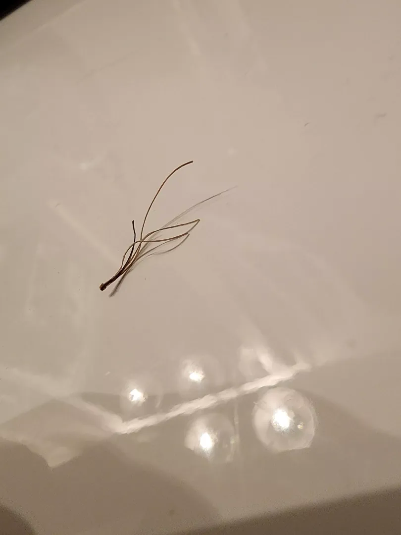 Sorry I didn't video it. One hair follicle squeeze produced this glorious bastard.