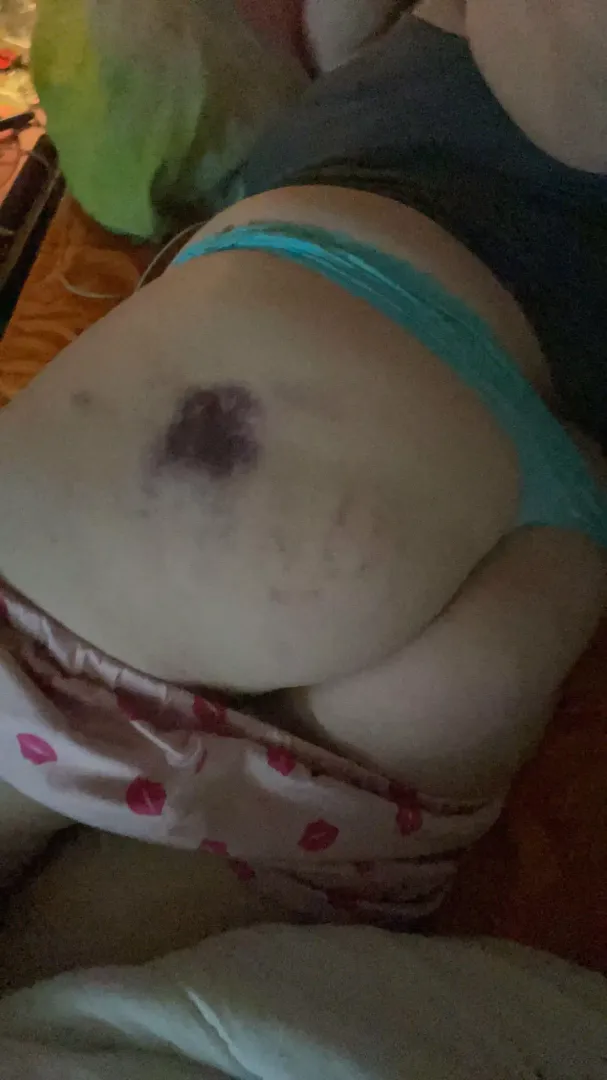 Spanked