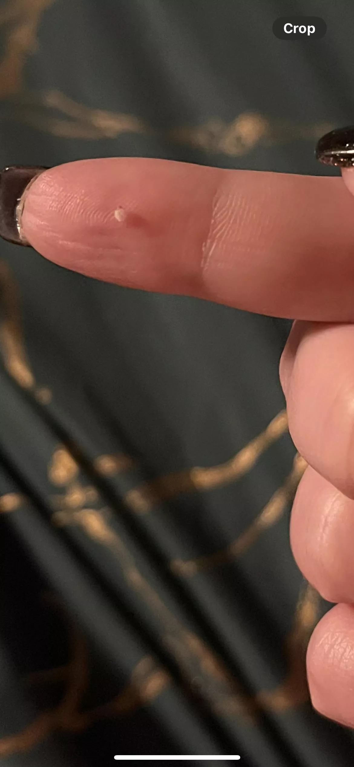 Squeezed this weird little thing out of the inside of my thigh this evening. It’s perfectly round and kinda hard. Wish I had gotten a video of it. 