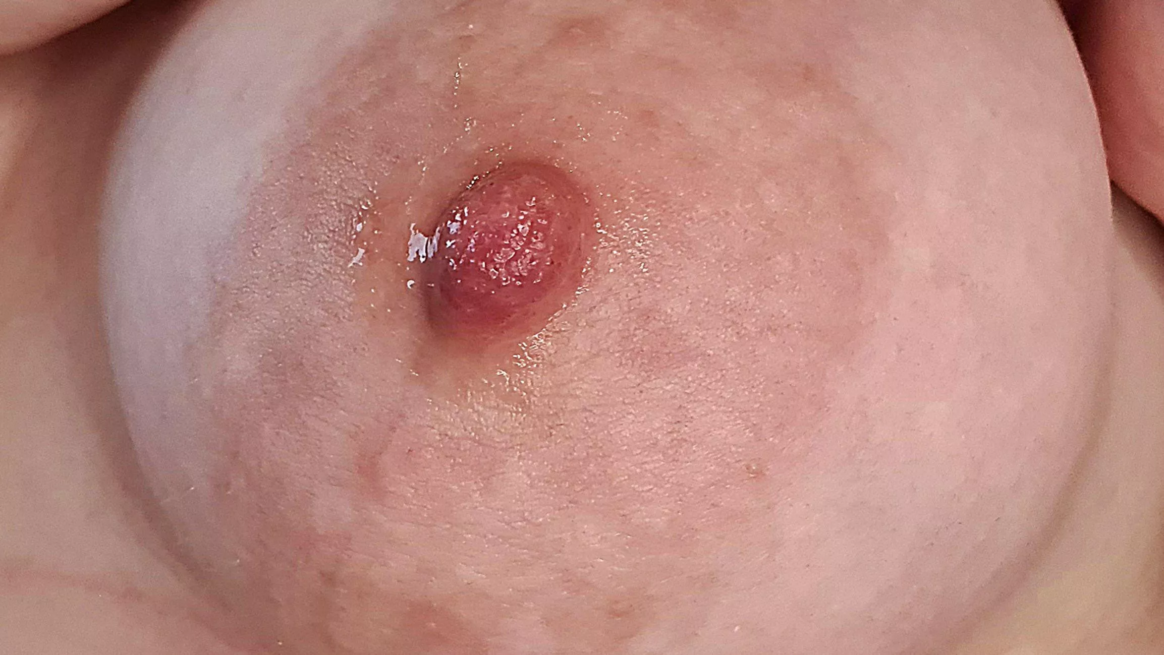 Suck on it
