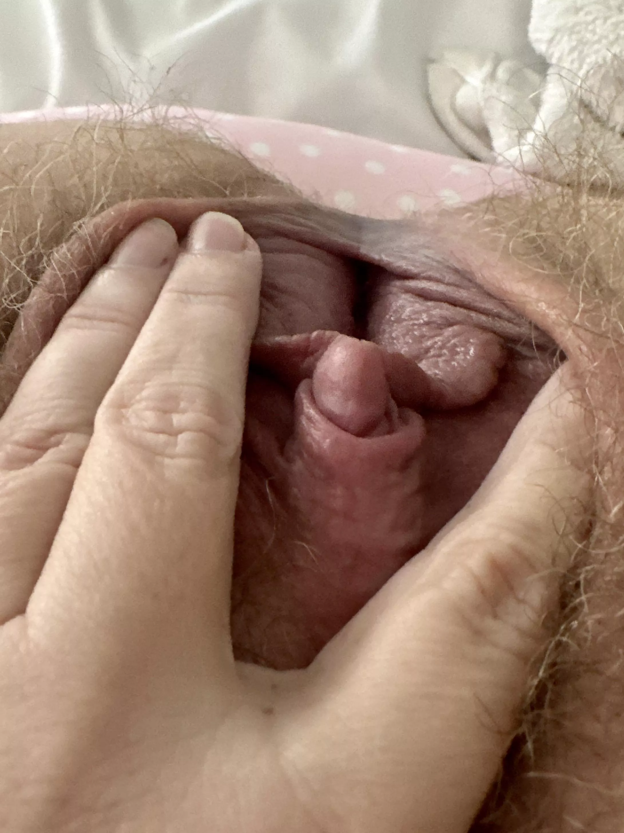 Suckable?