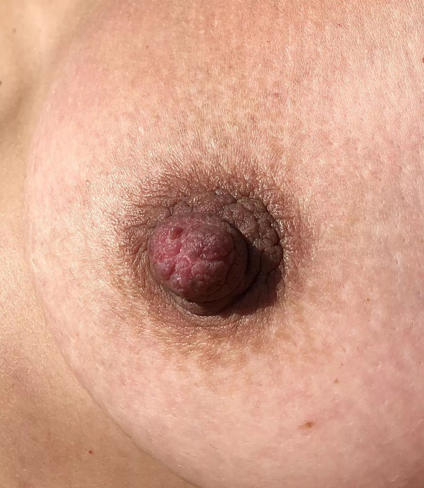 Suckable?
