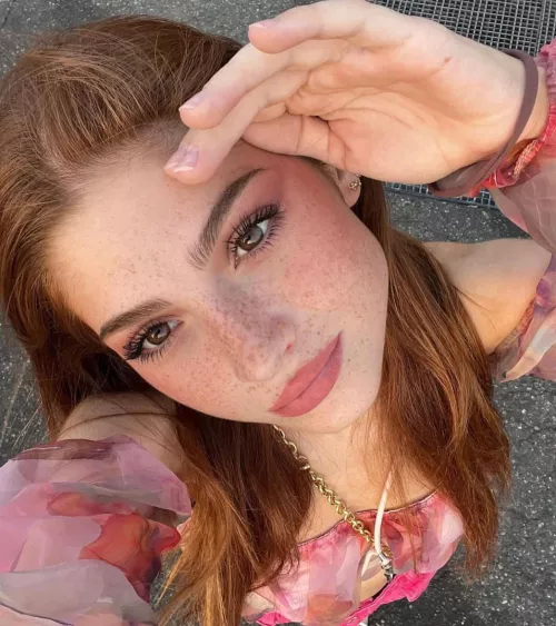 Sun kissed