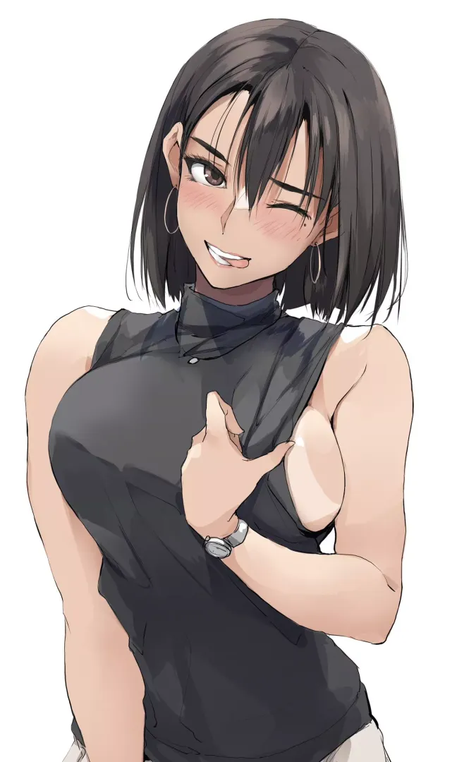 Sunburn marks [Artist's Original]