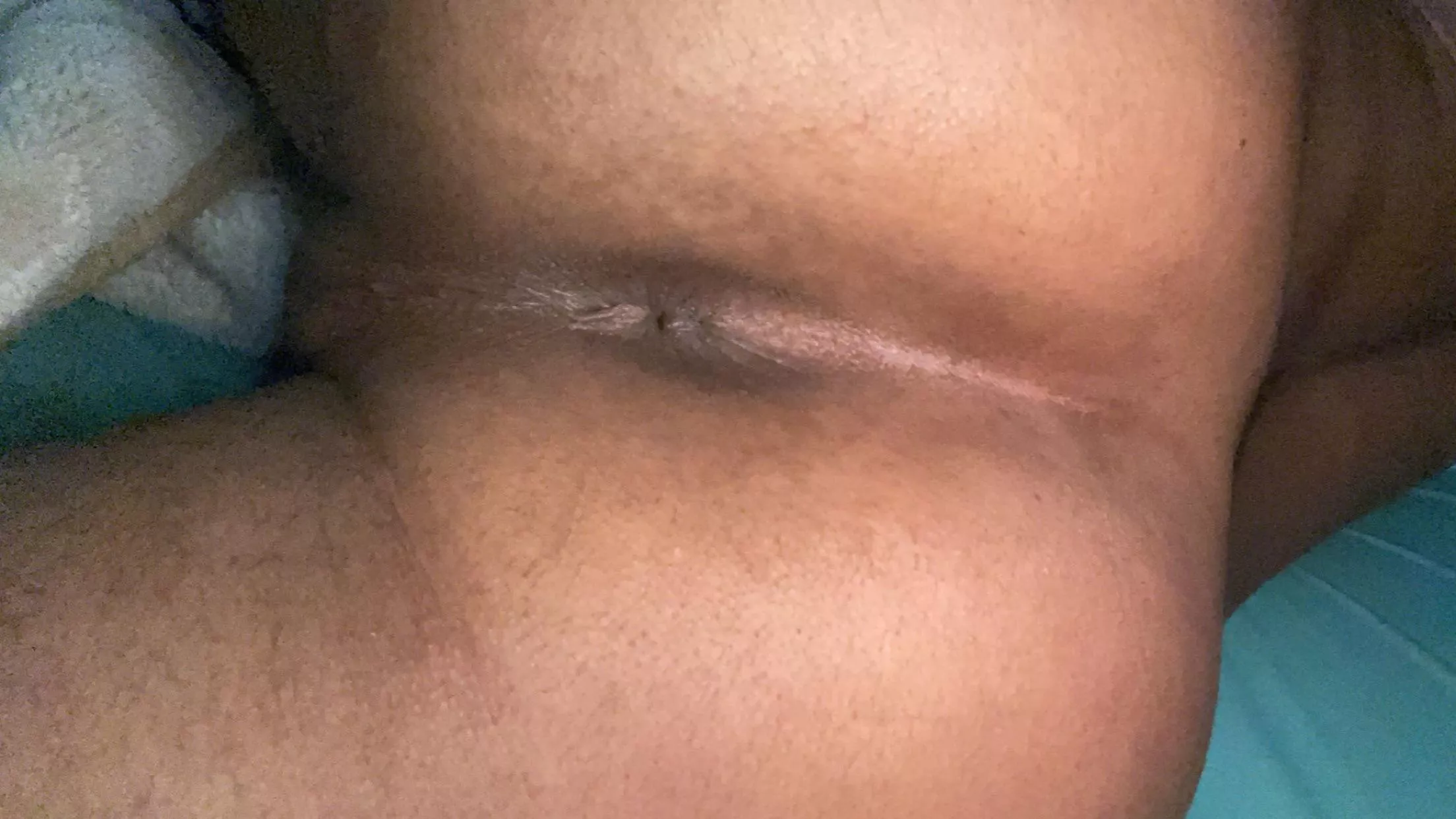 Sunning butthole ☀️