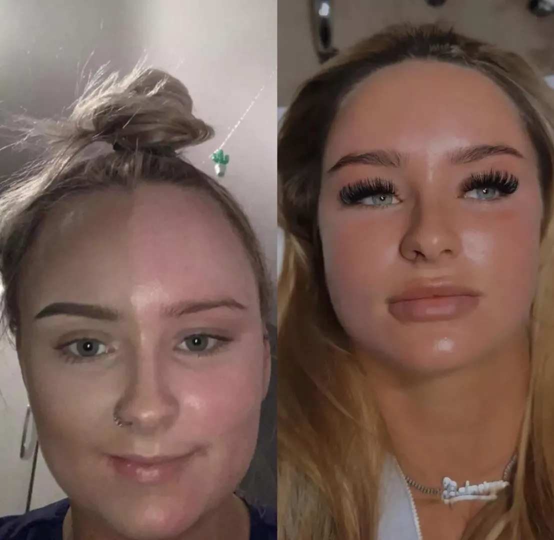 The difference three years (and various surgeries) can make! 😊