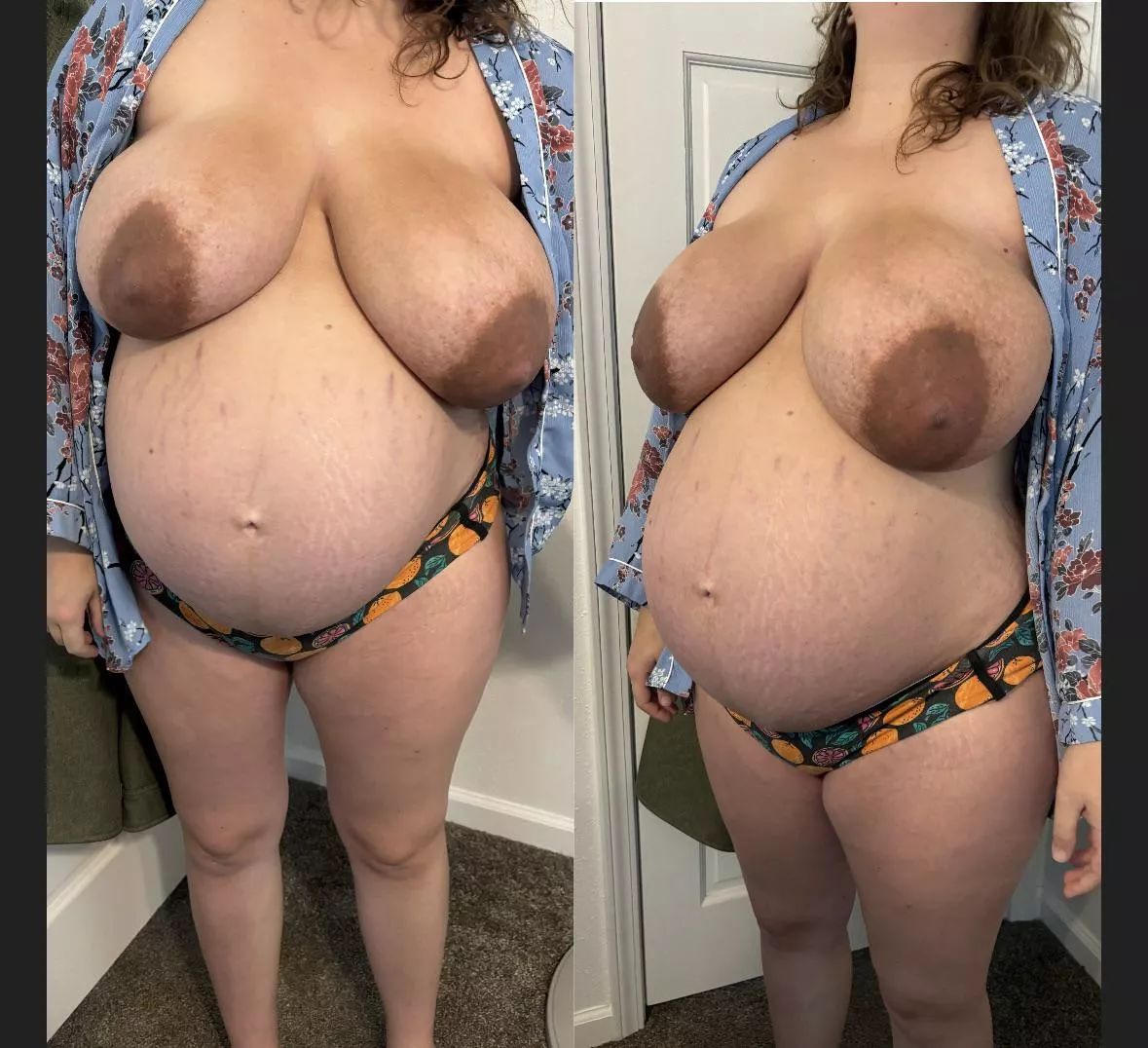 They’re starting to get swollen and engorged! They hurt! 