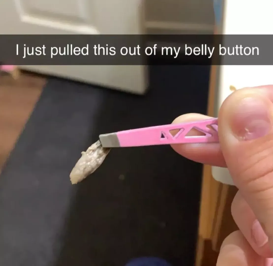 This came out of my belly button..