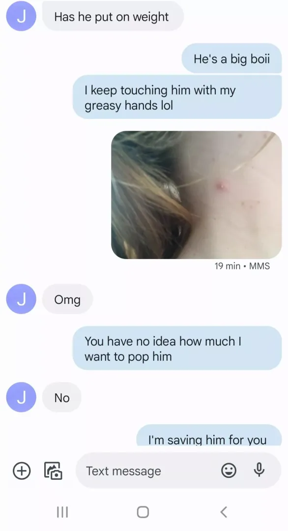 This neck pop has been giving me grief for months. I'm letting my boyfriend have the pleasure of popping it.