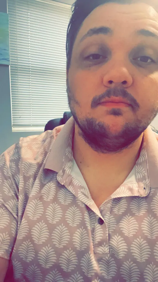 This ridiculous attempt at a beard’s gotta go soon.