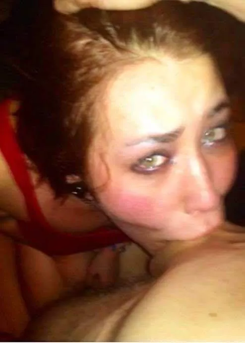 Throat abuse