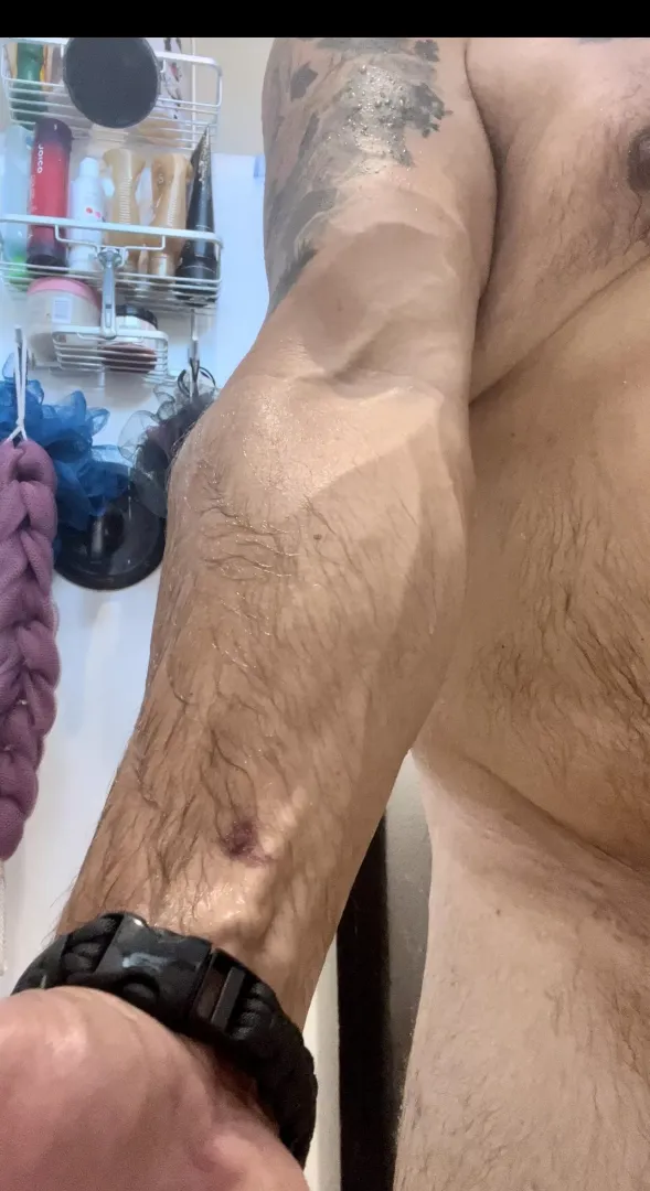 Thursday Veins