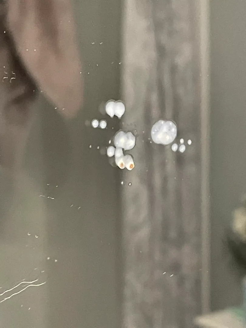 Tried to dig for tonsil stones but this sprayed out of the back of my throat instead