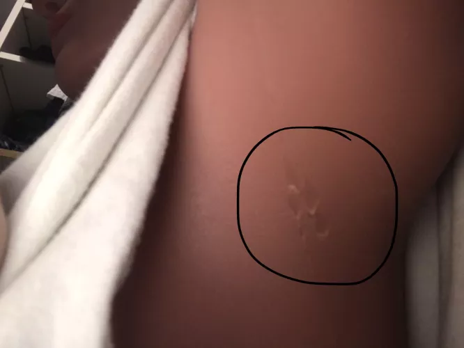 Ummm