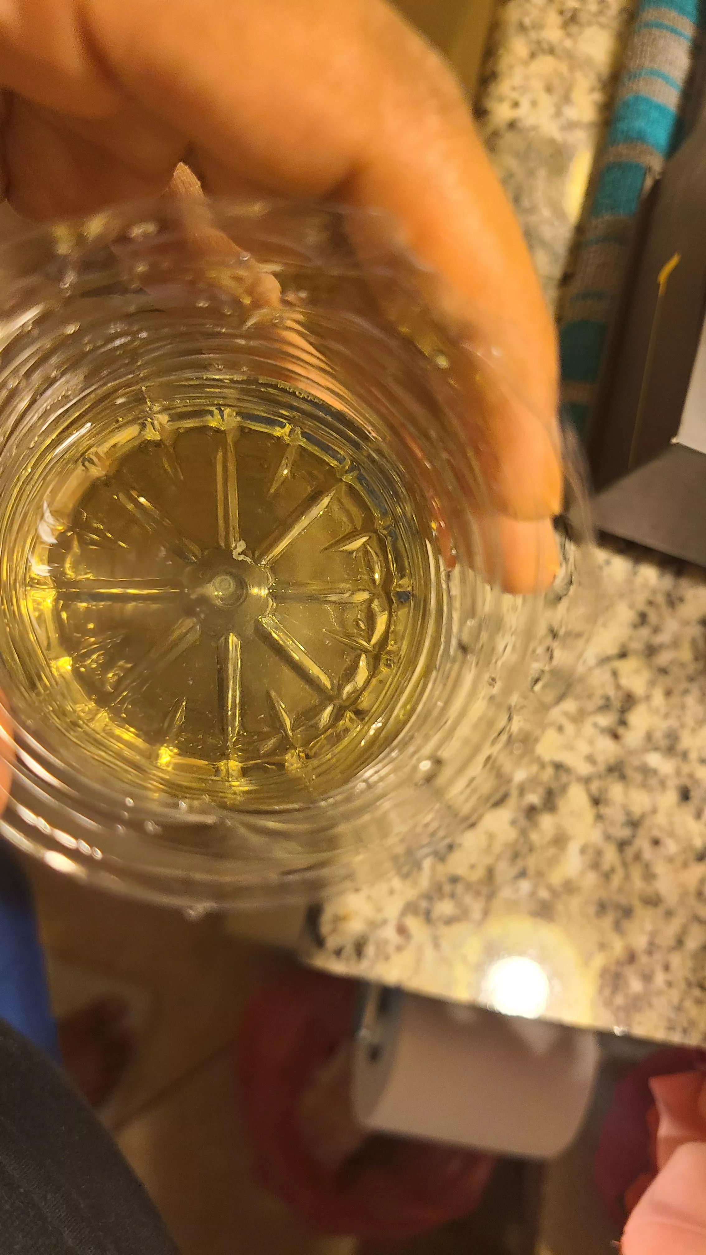 Urine- White Tissue Like Substance