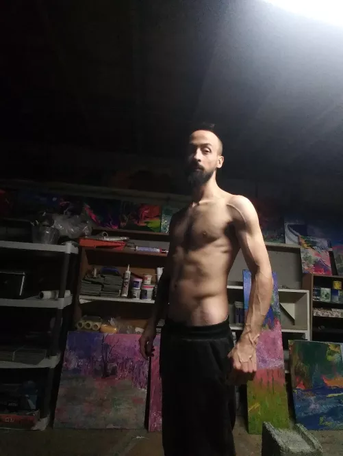 VascularAF