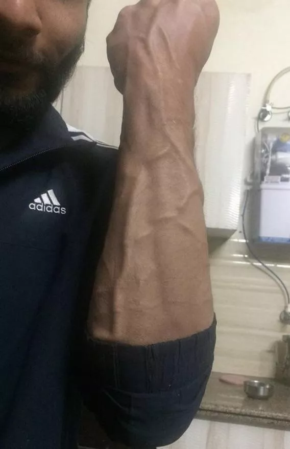 Vascularity